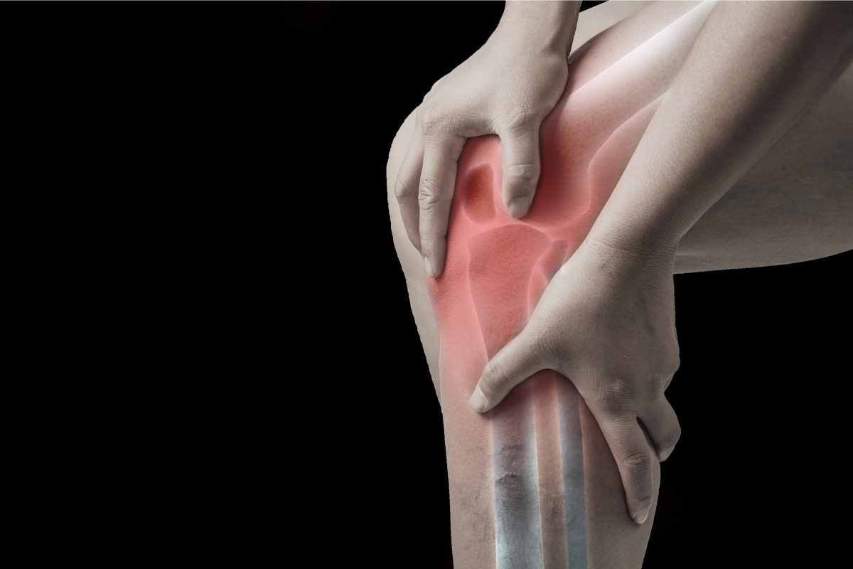 Knee Pain From Treadmill Causes & Prevention