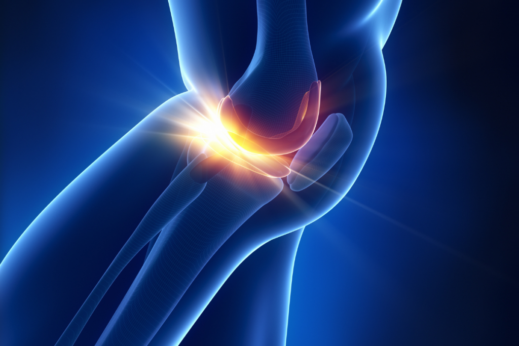 meniscus pain concept
