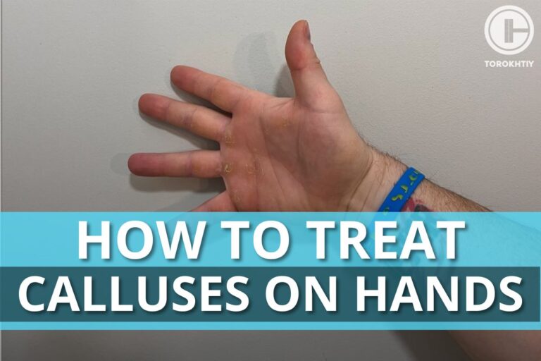 How To Treat Calluses On Hands From Weightlifting At Home?