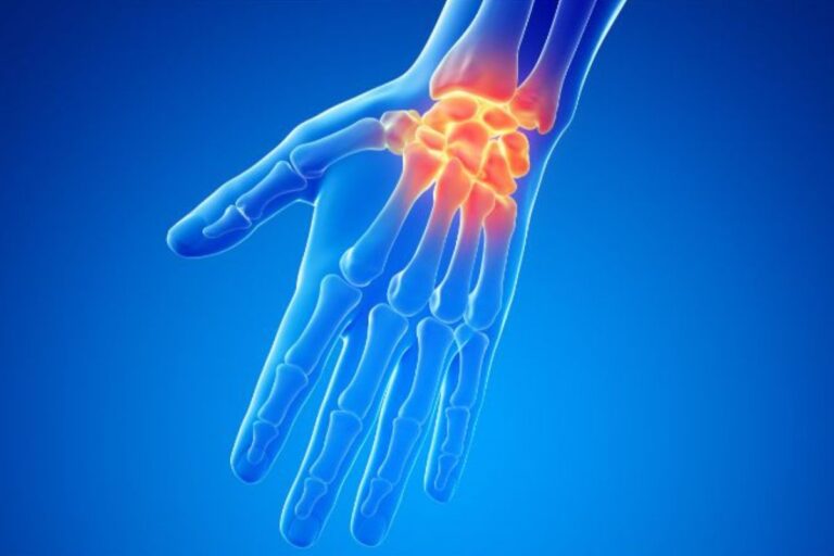 Wrist Pain From Lifting All Your Questions Answered