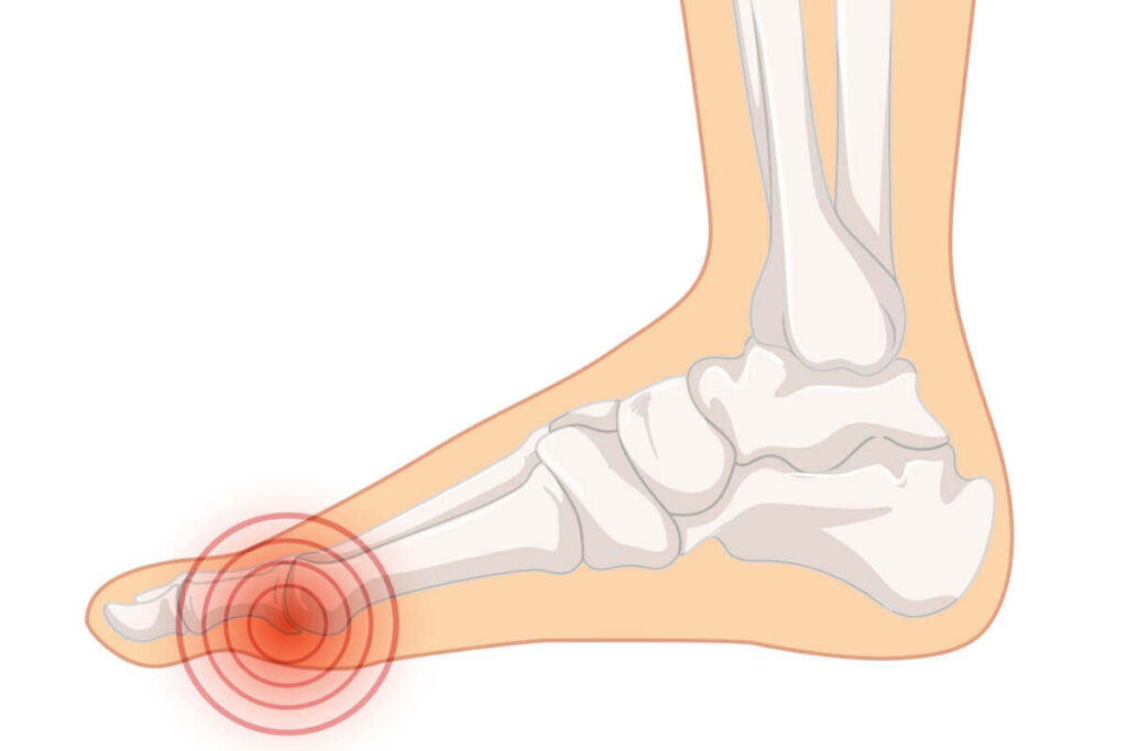 Anatomy Of The Big Toe